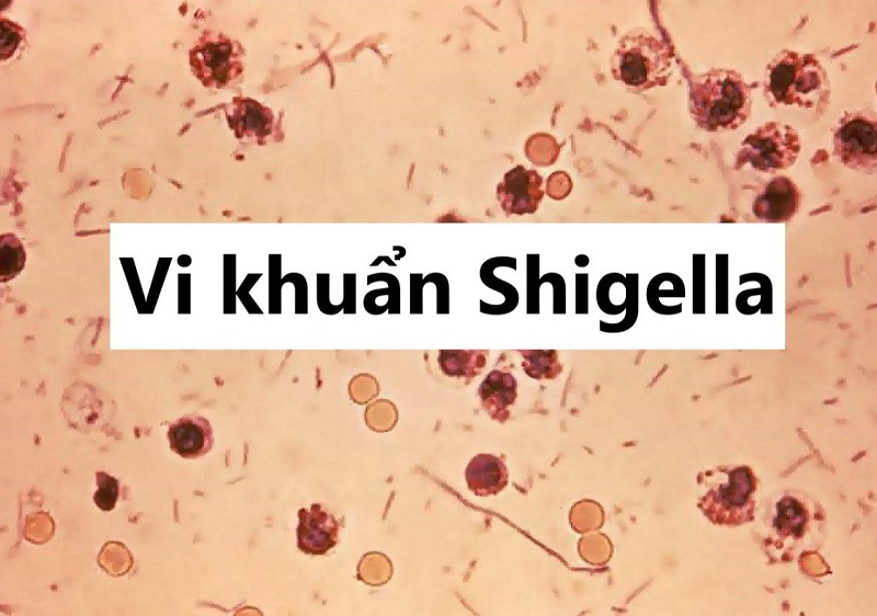 Vi khuẩn Shigella 